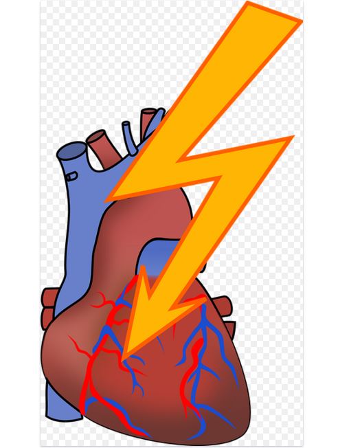 heart attack signs in women over 50 