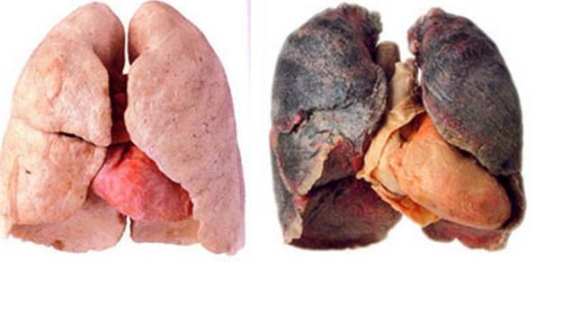 what does lung cancer look like